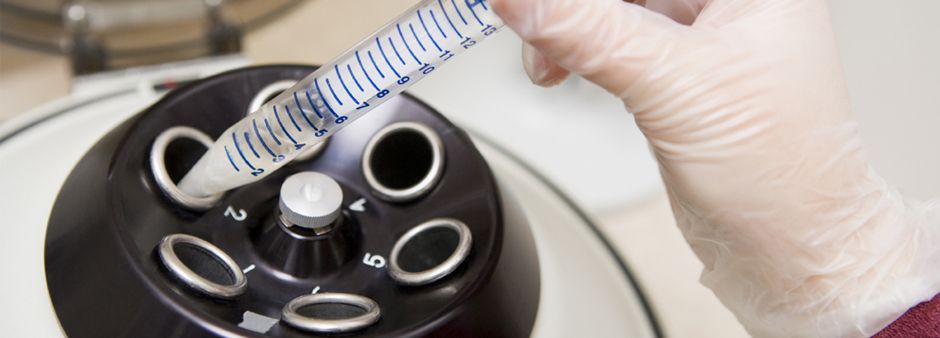 Tüp Bebek Merkezi Kilis 